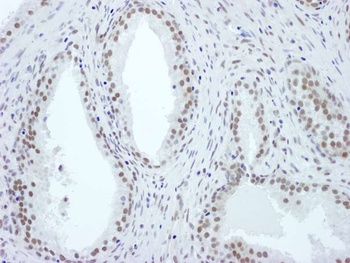 Rabbit ASH2 Antibody