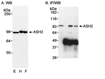 Rabbit ASH2 Antibody