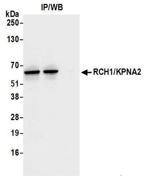 Rabbit RCH1/KPNA2 Antibody