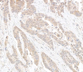 Rabbit DDX6 Antibody