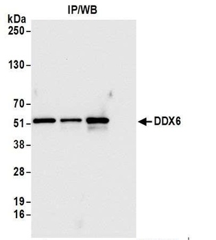 Rabbit DDX6 Antibody
