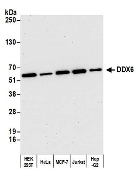 Rabbit DDX6 Antibody