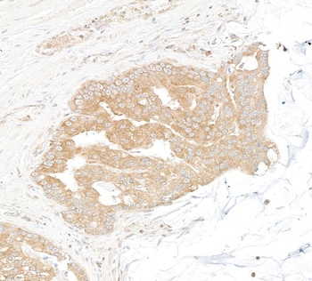 Rabbit DDX6 Antibody