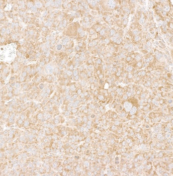 Rabbit DDX6 Antibody