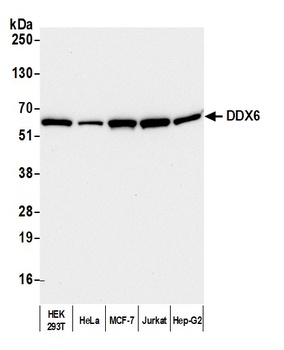 Rabbit DDX6 Antibody