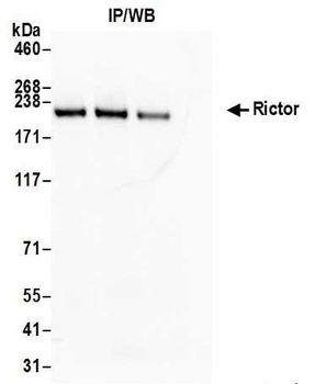 Rabbit Rictor Antibody