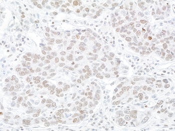Rabbit WSTF Antibody