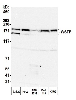 Rabbit WSTF Antibody