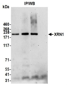 Rabbit XRN1 Antibody