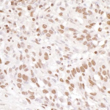 Rabbit EWS Antibody