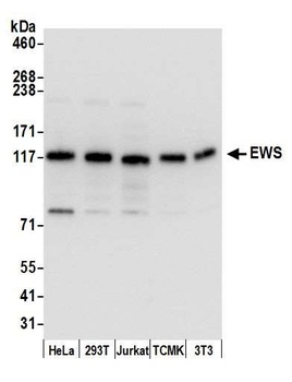 Rabbit EWS Antibody