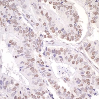 Rabbit ASC2 Antibody