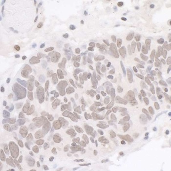 Rabbit CDK7 Antibody