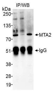 Rabbit MTA2 Antibody