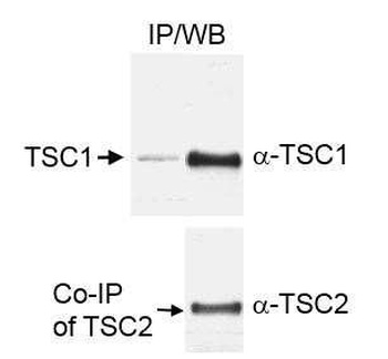 Rabbit TSC1 Antibody