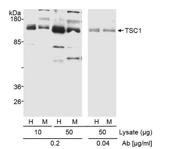 Rabbit TSC1 Antibody