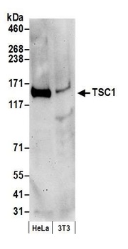 Rabbit TSC1 Antibody