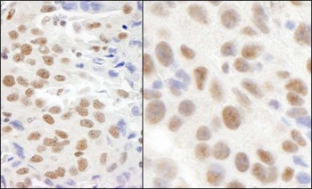 Rabbit KIAA0082 Antibody