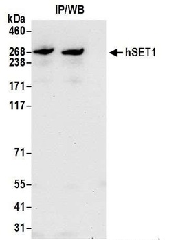 Rabbit hSET1 Antibody