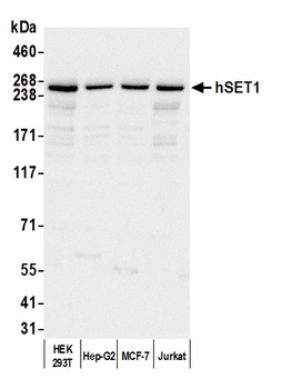 Rabbit hSET1 Antibody