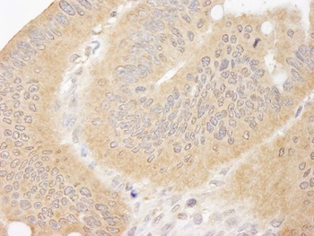 Rabbit CC2D1A Antibody
