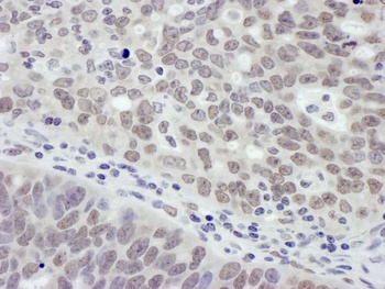 Rabbit MTA1 Antibody