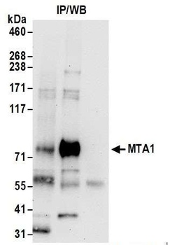 Rabbit MTA1 Antibody