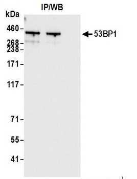 Rabbit 53BP1 Antibody