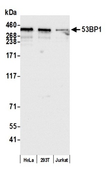 Rabbit 53BP1 Antibody
