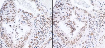 Rabbit RPA70 Antibody