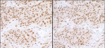 Rabbit RPA70 Antibody