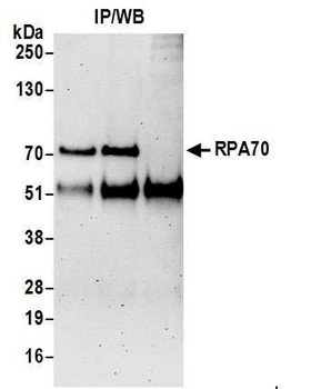 Rabbit RPA70 Antibody