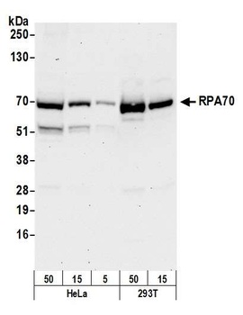 Rabbit RPA70 Antibody