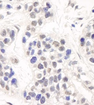 Rabbit Artemis Antibody
