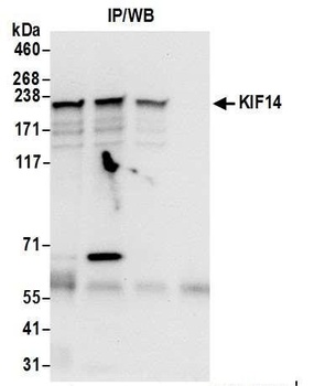 Rabbit KIF14 Antibody