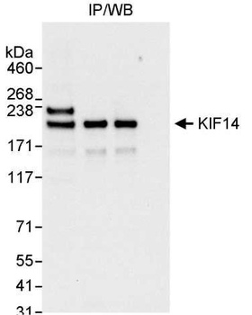 Rabbit KIF14 Antibody