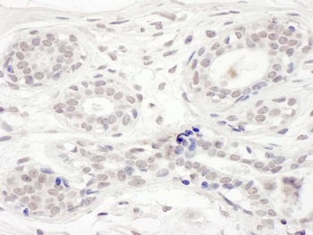 Rabbit BRD8 Antibody