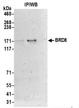 Rabbit BRD8 Antibody