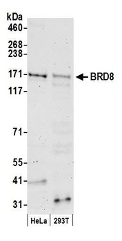 Rabbit BRD8 Antibody