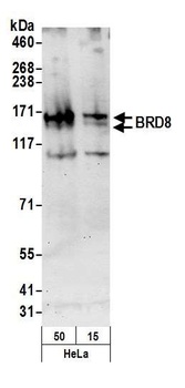 Rabbit BRD8 Antibody