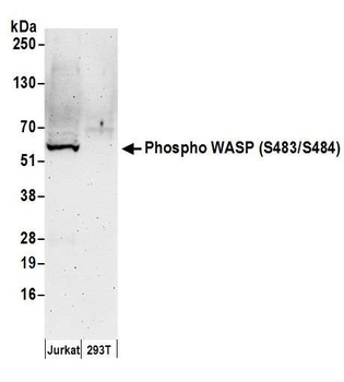Rabbit Phospho WASP (S483/S484) Antibody