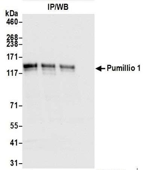 Goat Pumilio 1 Antibody