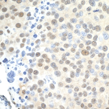 Rabbit PELP1/MNAR Antibody