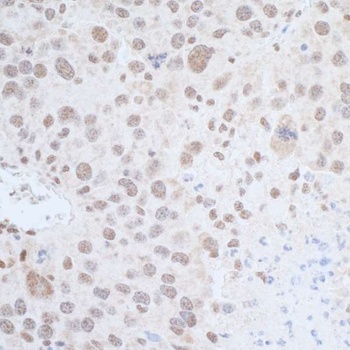 Rabbit Leo1 Antibody