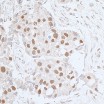 Rabbit Leo1 Antibody