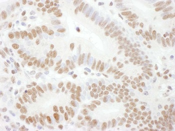 Rabbit Phospho Rad17 (S645) Antibody