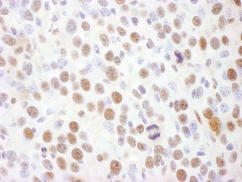 Rabbit Phospho Rad17 (S645) Antibody