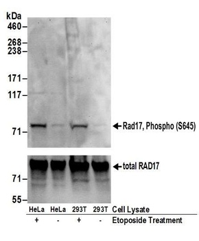 Rabbit Phospho Rad17 (S645) Antibody