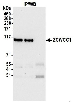 Rabbit ZCWCC1 Antibody
