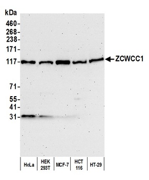 Rabbit ZCWCC1 Antibody